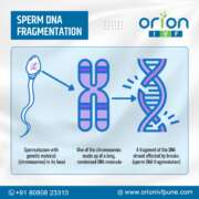 Sperm DNA fragmentation test | Orion IVF Pune